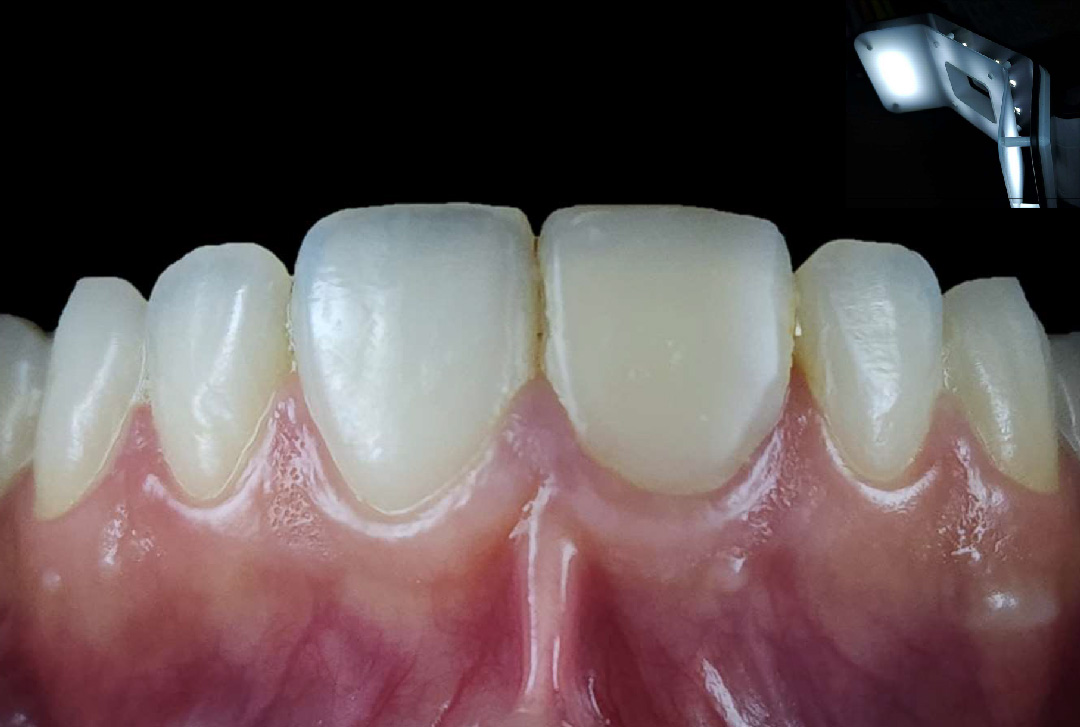 style italiano styleitaliano Initial intra-oral situation