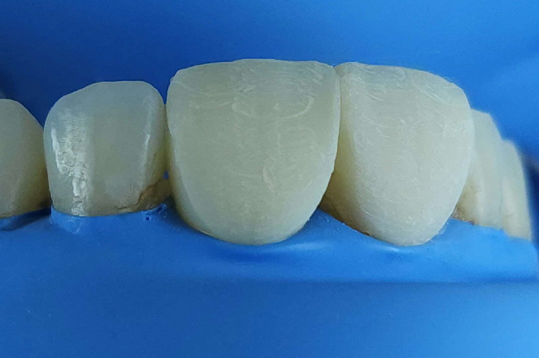 style italiano styleitaliano Shaping of the anterior restorations