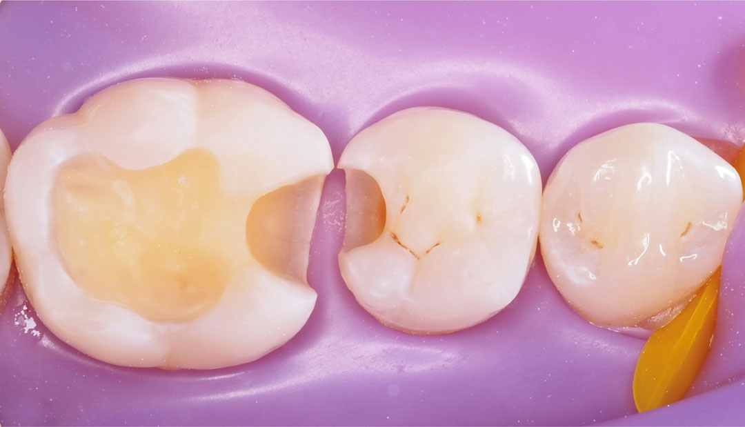 style italiano styleitaliano The cavity after sandblasting
