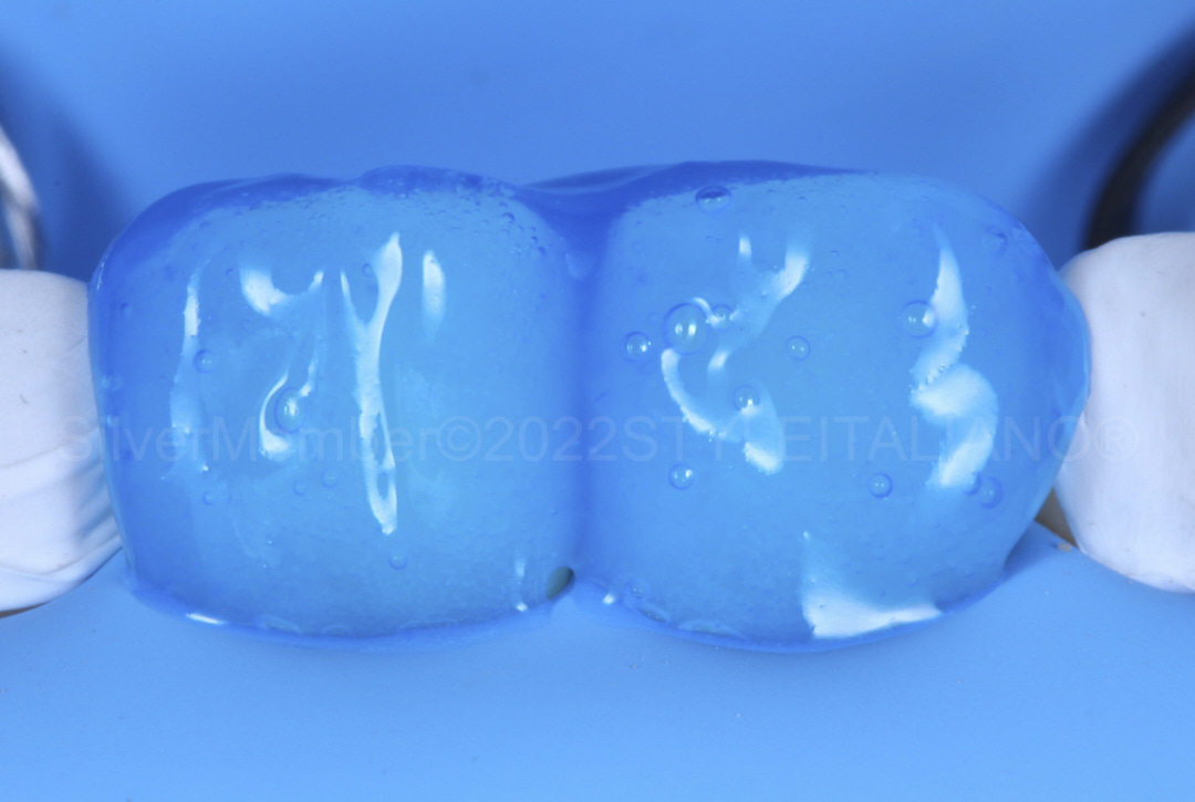 styleitaliano style italiano etching gel on teeth