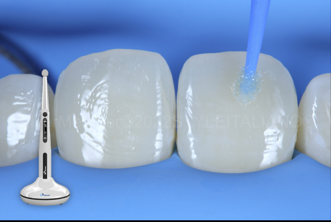 styleitaliano style italiano bonding teeth and light curing lamp