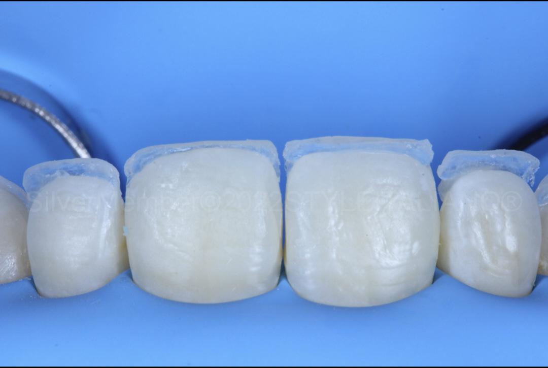styleitaliano style italiano palatal composite shells