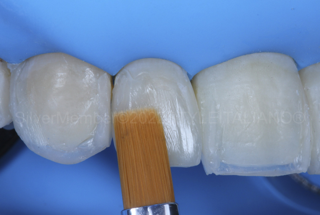 styleitaliano style italiano brushing composite enamel layer