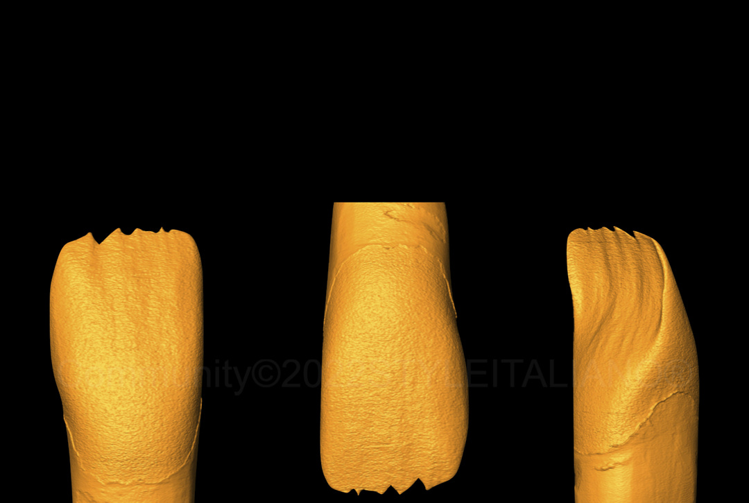 styleitaliano style italiano 3d anatomical incisor model without enamel