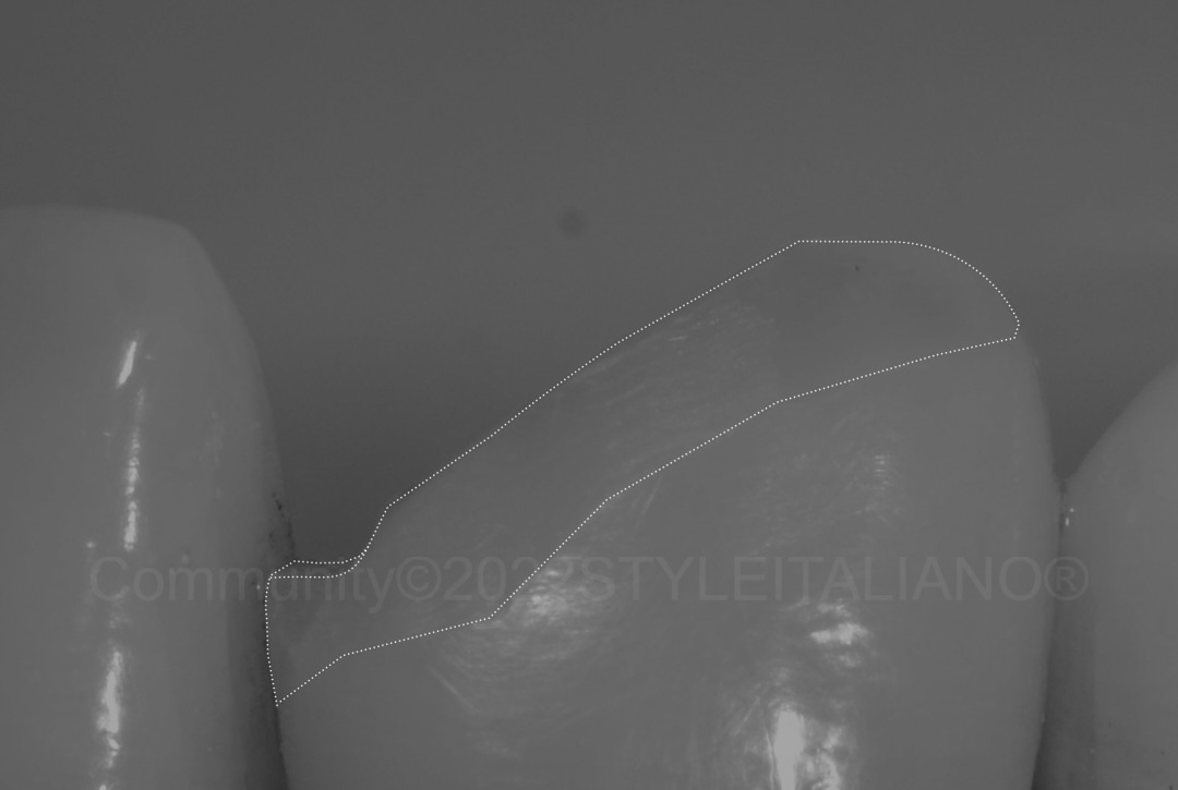styleitaliano style italiano highlight of long bevel preparation