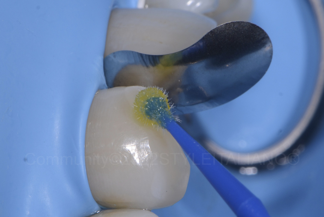 styleitaliano style italiano bonding incisor with a micro brush