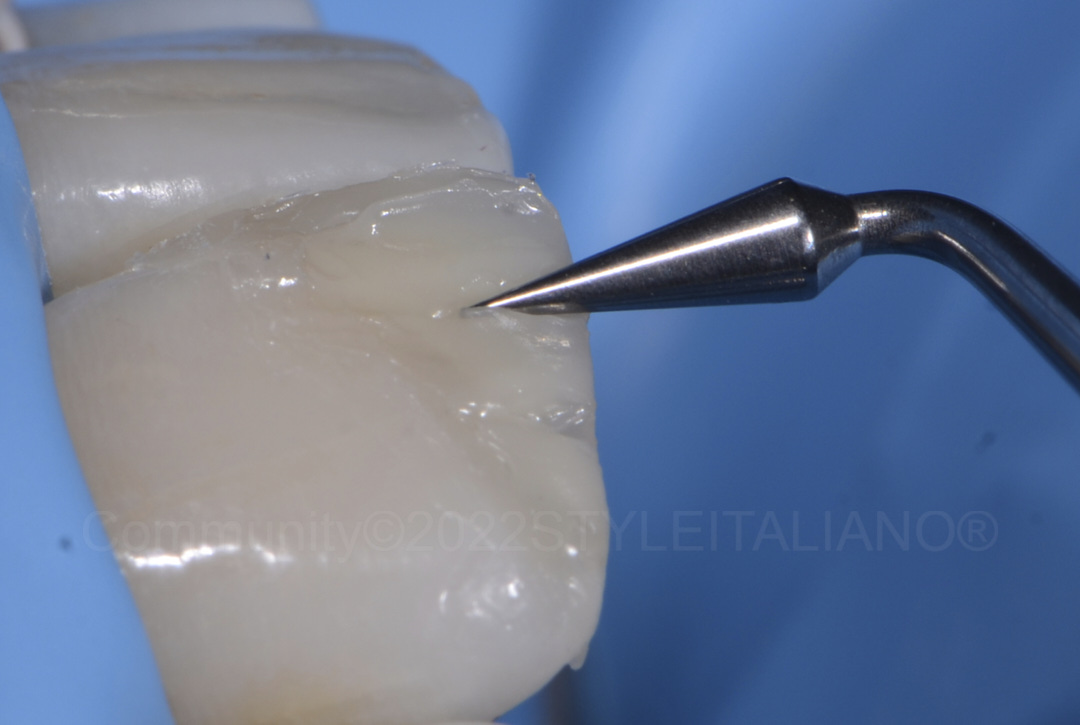 styleitaliano style italiano modeling internal anatomy with composite