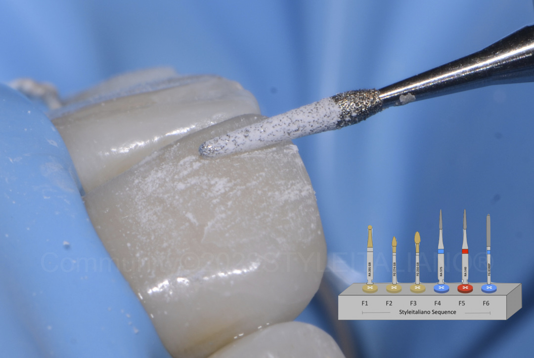 styleitaliano style italiano perio diamond finishing bur