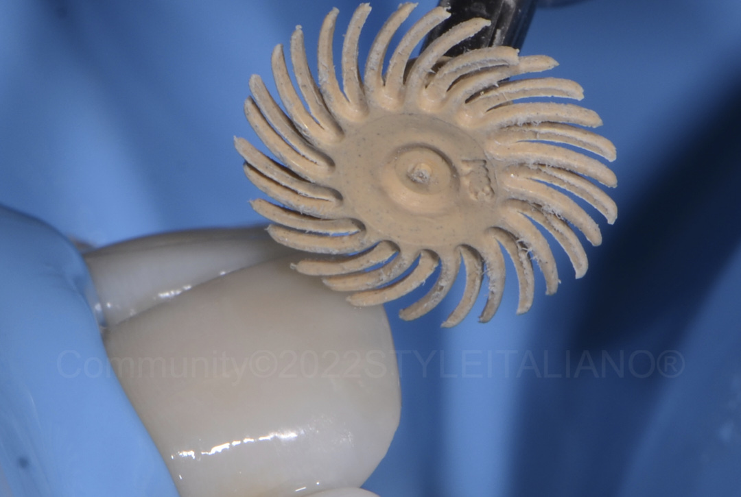 styleitaliano style italiano polishing composite with spiral wheel